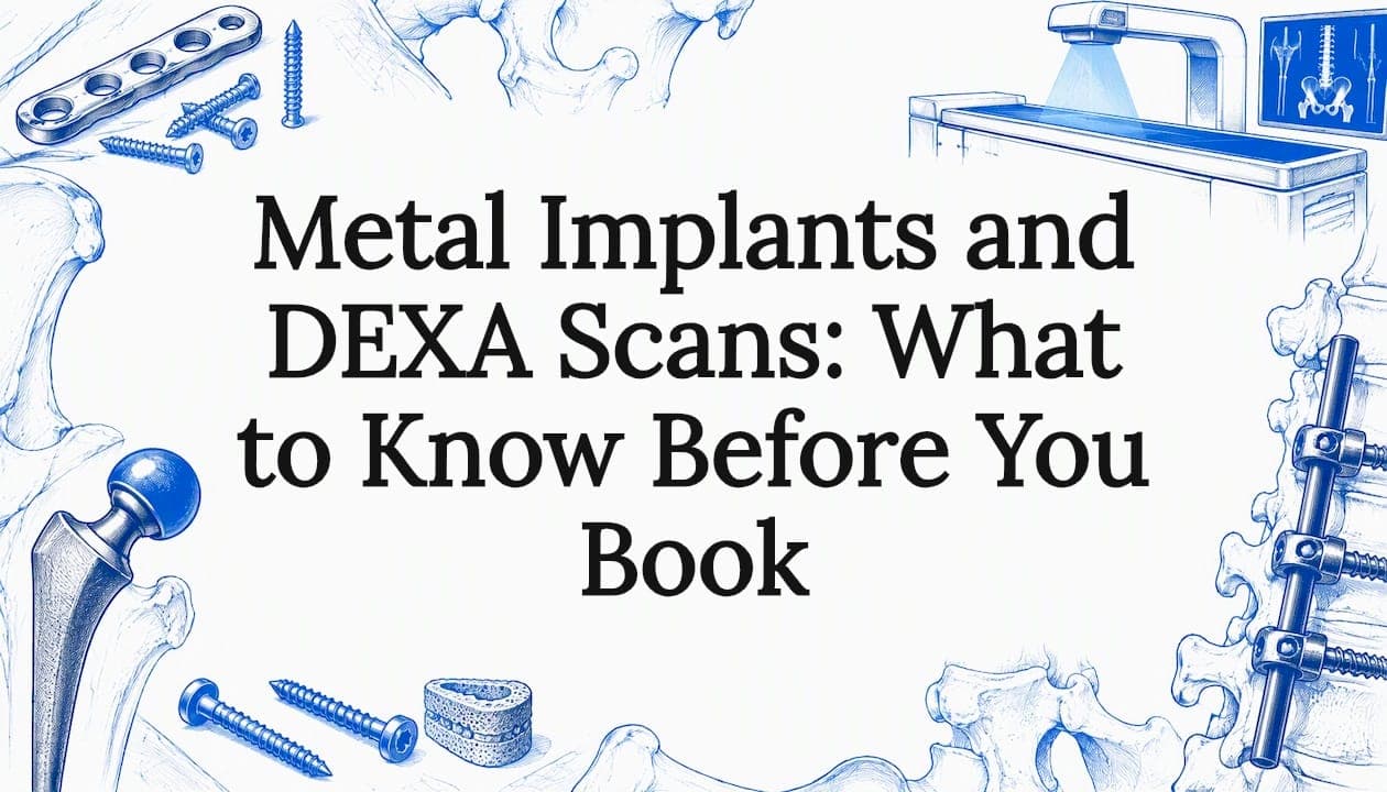 Metal Implants and DEXA Scans: What to Know Before You Book